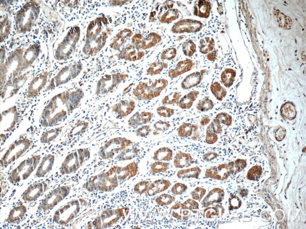 Immunohistochemistry (IHC) staining of human stomach tissue using ADA Polyclonal antibody (13328-1-AP)