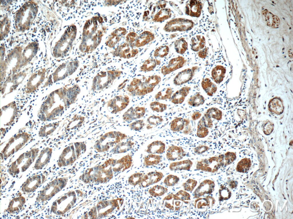 ADA Polyclonal antibody