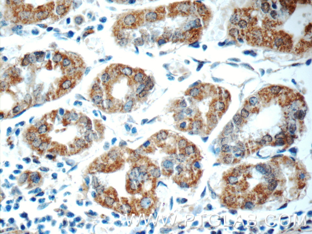 Immunohistochemistry (IHC) staining of human stomach tissue using ADA Polyclonal antibody (13328-1-AP)