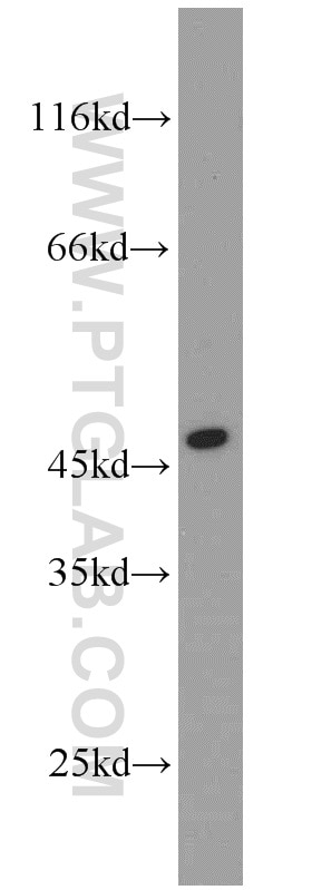 WB analysis of Sp2/0 using 13328-1-AP