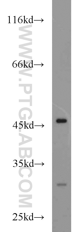 Western Blot (WB) analysis of Jurkat cells using ADA Polyclonal antibody (13328-1-AP)