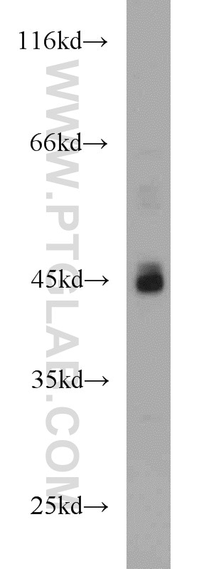 Western Blot (WB) analysis of HeLa cells using ADA Polyclonal antibody (13328-1-AP)