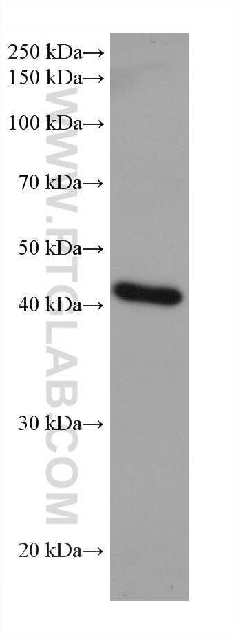 Western Blot (WB) analysis of LNCaP cells using ADA Monoclonal antibody (67870-1-Ig)