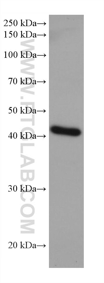 WB analysis of LNCaP using 67870-1-Ig