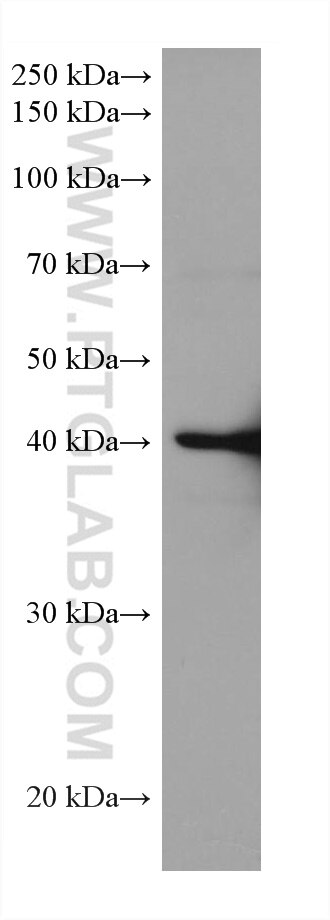 Western Blot (WB) analysis of HEK-293 cells using ADA Monoclonal antibody (67870-1-Ig)