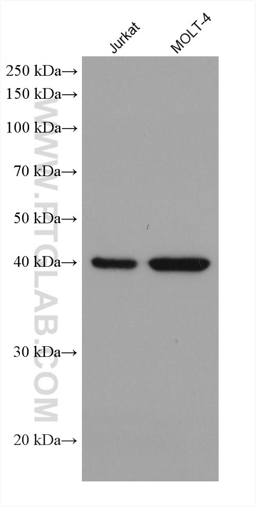 Western Blot (WB) analysis of various lysates using ADA Monoclonal antibody (67870-1-Ig)