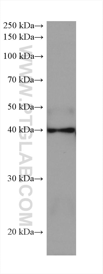 Western Blot (WB) analysis of rat spleen tissue using ADA Monoclonal antibody (67870-1-Ig)