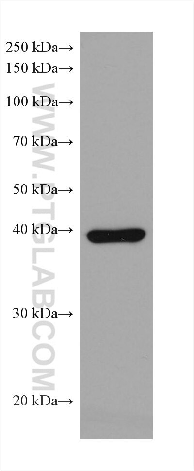 Western Blot (WB) analysis of rabbit spleen tissue using ADA Monoclonal antibody (67870-1-Ig)