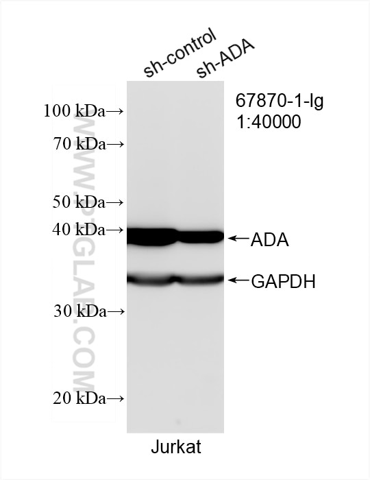 Western Blot (WB) analysis of Jurkat cells using ADA Monoclonal antibody (67870-1-Ig)