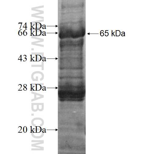 ADA fusion protein Ag4128 SDS-PAGE