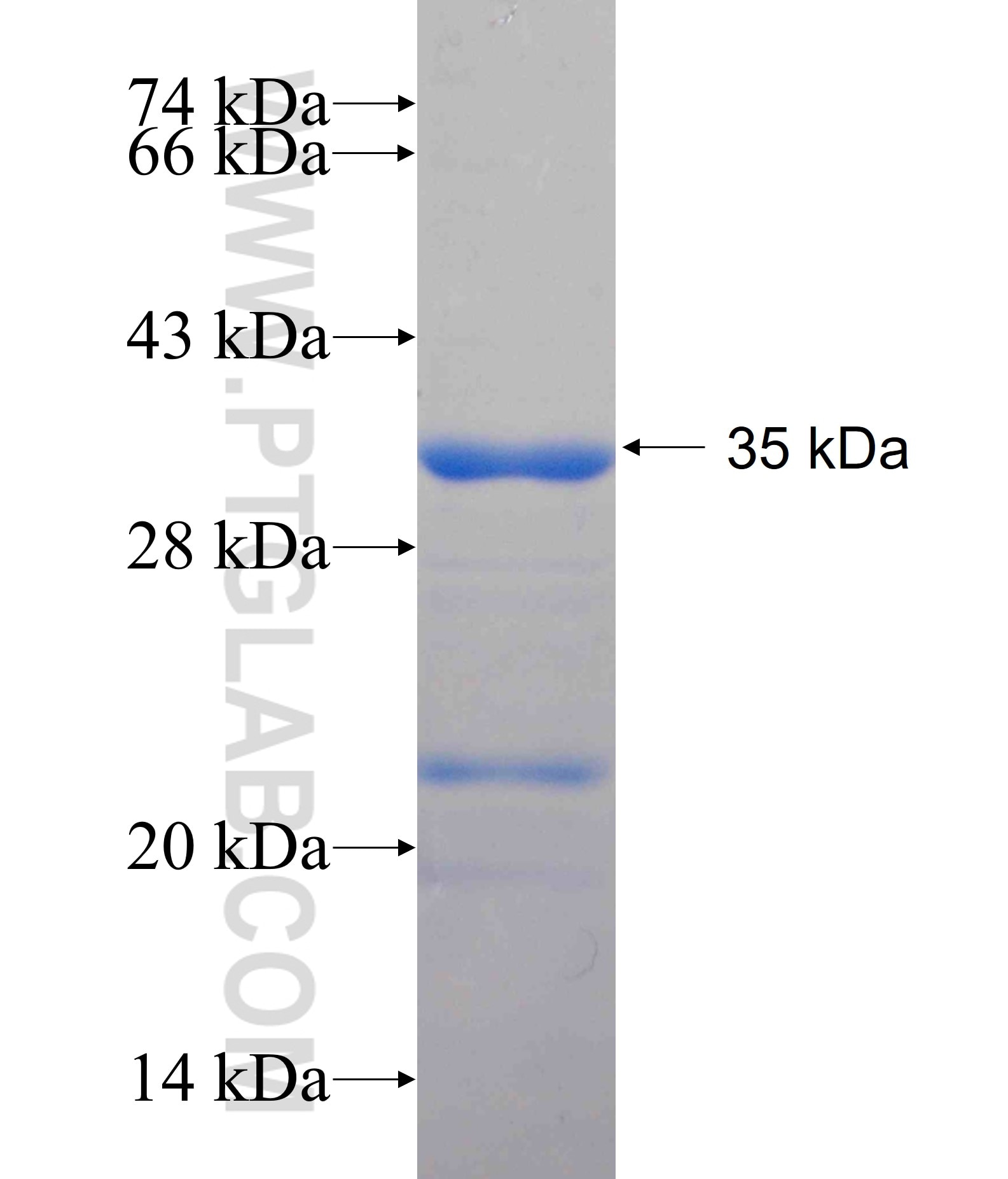 ADAD1 fusion protein Ag25966 SDS-PAGE