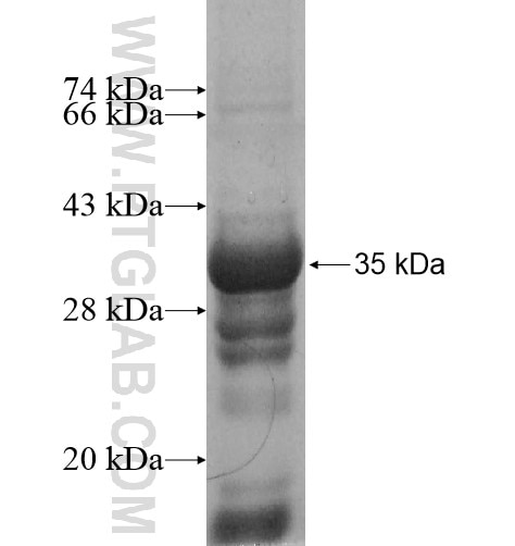 ADAD1 fusion protein Ag15425 SDS-PAGE