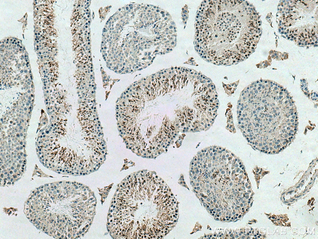 Immunohistochemistry (IHC) staining of mouse testis tissue using ADAD2 Polyclonal antibody (21217-1-AP)