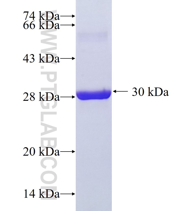 ADAD2 fusion protein Ag36554 SDS-PAGE ADAD2 fusion protein Ag36554 SDS-PAGE