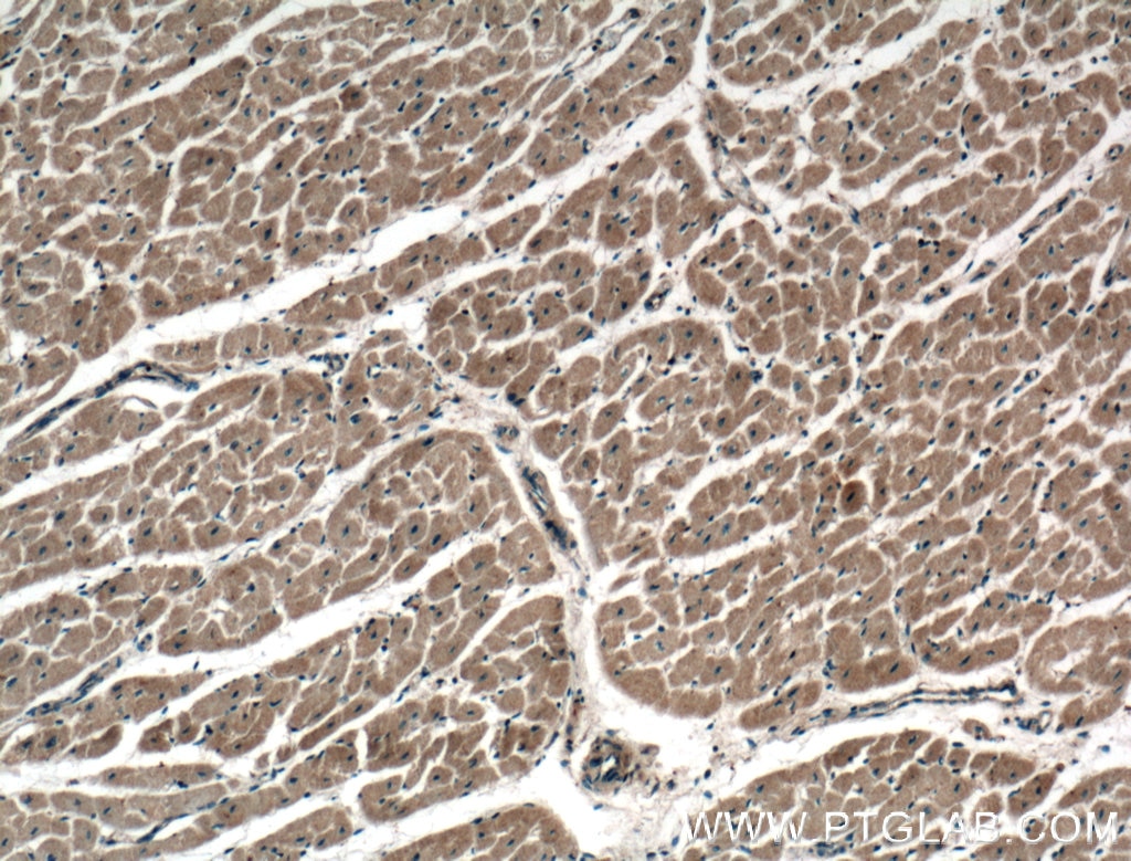 Immunohistochemistry (IHC) staining of human heart tissue using ADAL Polyclonal antibody (27369-1-AP)