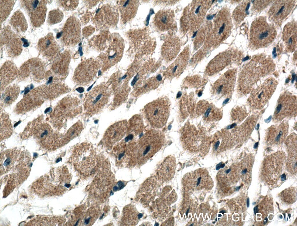 Immunohistochemistry (IHC) staining of human heart tissue using ADAL Polyclonal antibody (27369-1-AP)