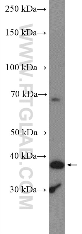 Western Blot (WB) analysis of LNCaP cells using ADAL Polyclonal antibody (27369-1-AP)