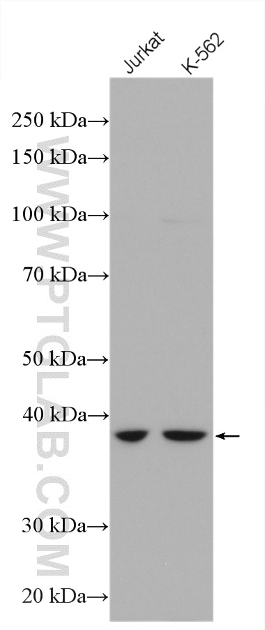 Western Blot (WB) analysis of various lysates using ADAL Polyclonal antibody (27369-1-AP)