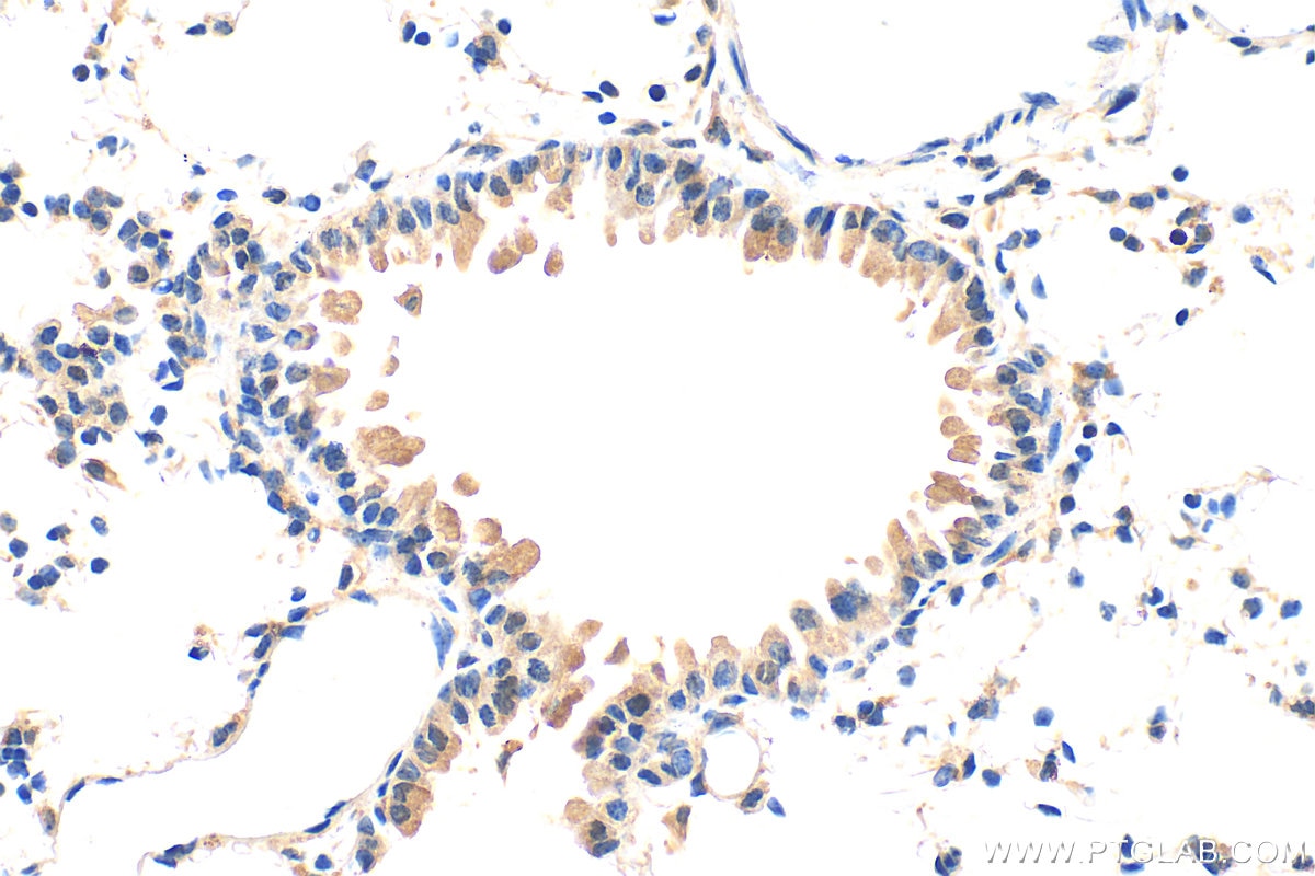 Immunohistochemistry (IHC) staining of mouse lung tissue using ADAM11 Polyclonal antibody (32970-1-AP)
