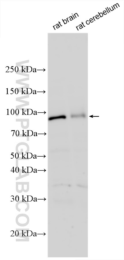 Western Blot (WB) analysis of various lysates using ADAM11 Polyclonal antibody (32970-1-AP)