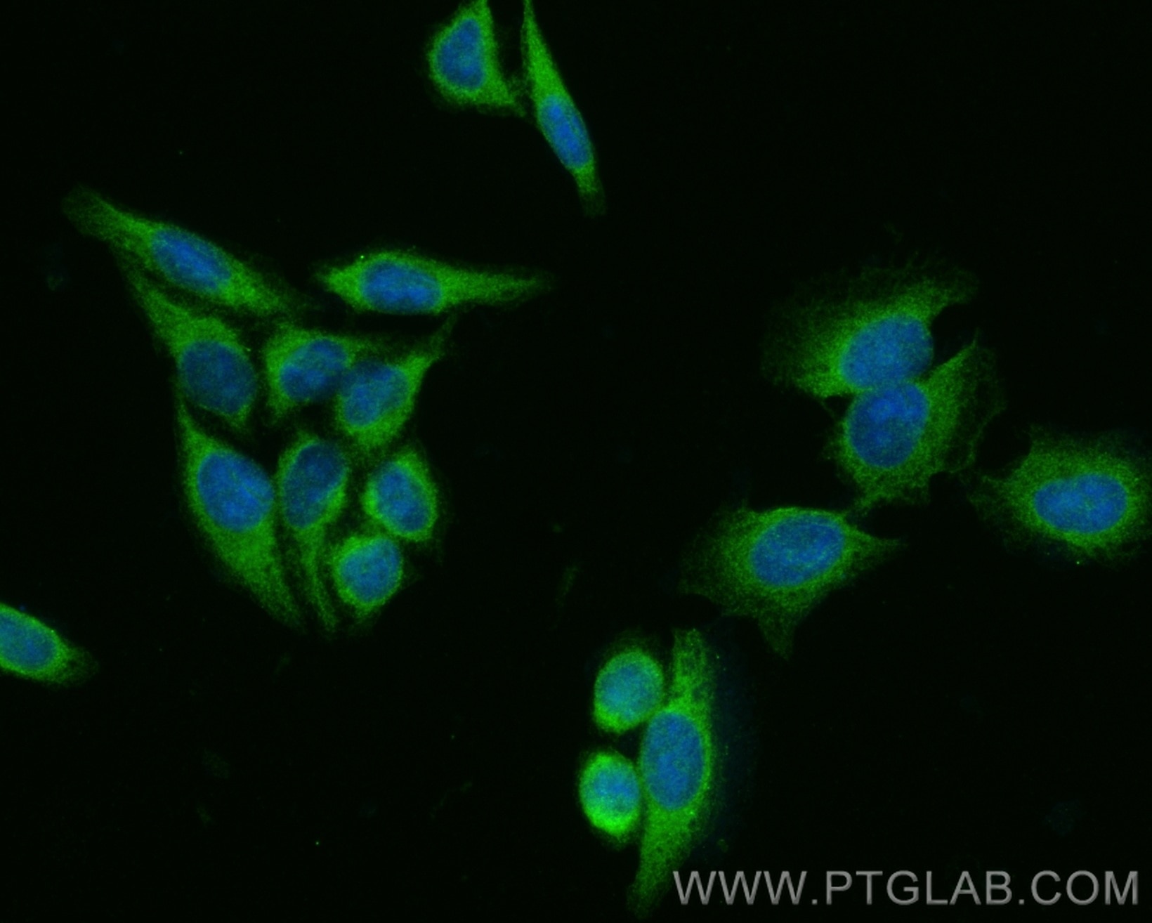 Immunofluorescence (IF) / fluorescent staining of HepG2 cells using ADAM12 Polyclonal antibody (14139-1-AP)