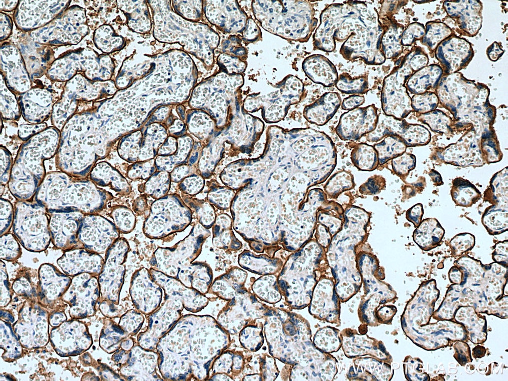 Immunohistochemistry (IHC) staining of human placenta tissue using ADAM12 Polyclonal antibody (14139-1-AP)