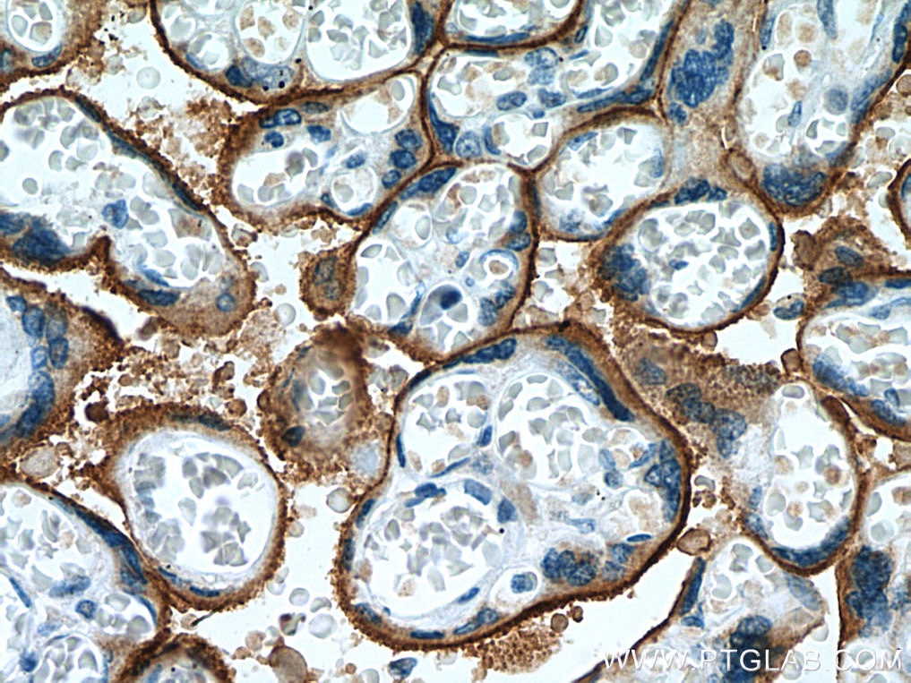 Immunohistochemistry (IHC) staining of human placenta tissue using ADAM12 Polyclonal antibody (14139-1-AP)