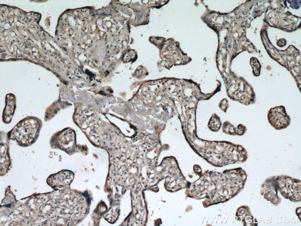 Immunohistochemistry (IHC) staining of human placenta tissue using ADAM12 Polyclonal antibody (14139-1-AP)