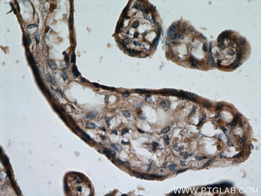 IHC staining of human placenta using 14139-1-AP