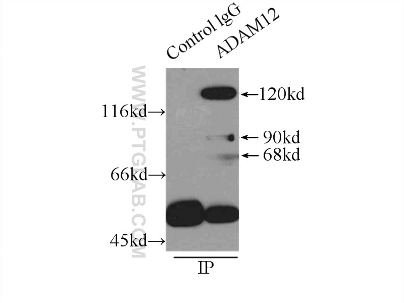 Immunoprecipitation (IP) experiment of HeLa cells using ADAM12 Polyclonal antibody (14139-1-AP)