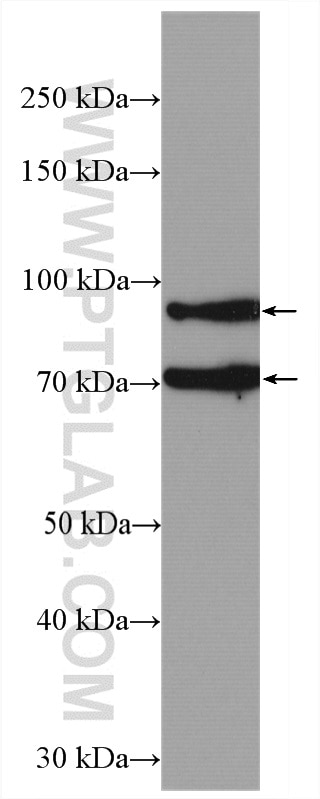 Western Blot (WB) analysis of mouse brain tissue using ADAM12 Polyclonal antibody (14139-1-AP)