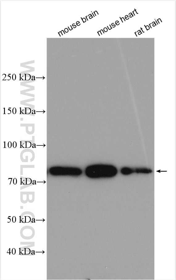 Western Blot (WB) analysis of various lysates using ADAM12 Polyclonal antibody (14139-1-AP)
