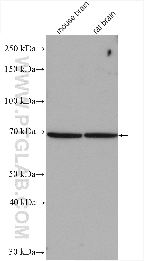 Western Blot (WB) analysis of various lysates using ADAM12 Polyclonal antibody (26928-1-AP)