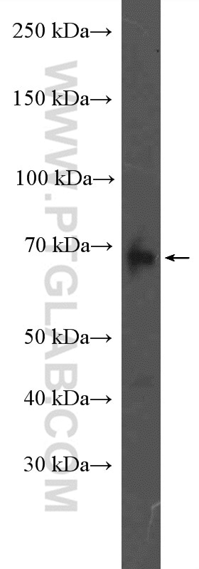Western Blot (WB) analysis of A431 cells using ADAM12 Polyclonal antibody (26928-1-AP)