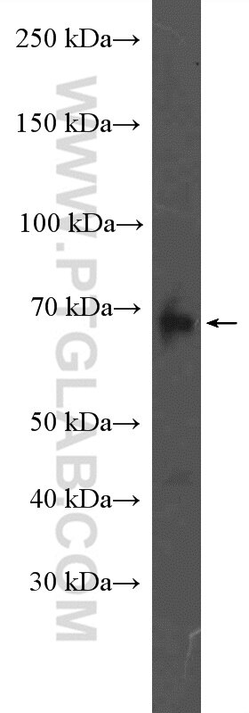 Western Blot (WB) analysis of A431 cells using ADAM12 Polyclonal antibody (26928-1-AP)