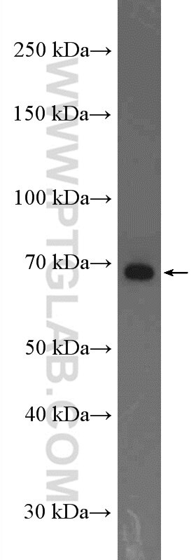 Western Blot (WB) analysis of mouse brain tissue using ADAM12 Polyclonal antibody (26928-1-AP)