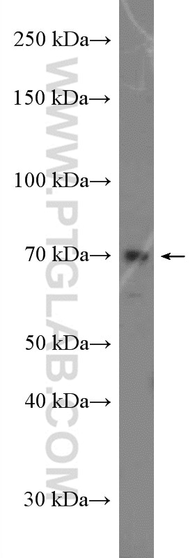 Western Blot (WB) analysis of A549 cells using ADAM12 Polyclonal antibody (26928-1-AP)