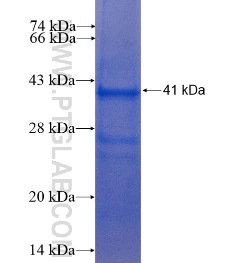 ADAM12 fusion protein Ag5245 SDS-PAGE