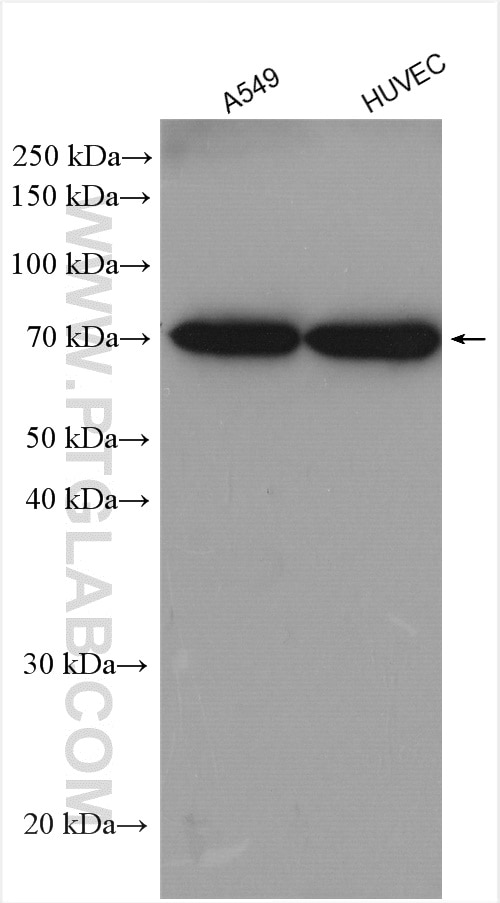 Western Blot (WB) analysis of various lysates using ADAM15 Polyclonal antibody (27124-1-AP)