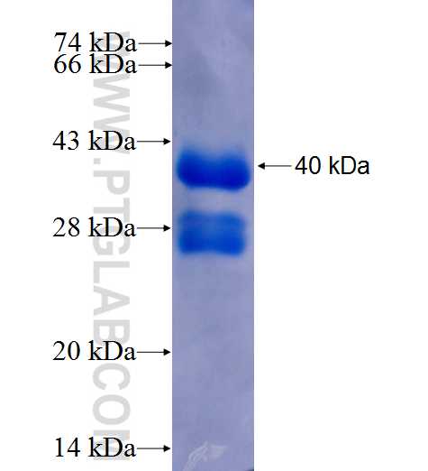 ADAM15 fusion protein Ag25947 SDS-PAGE