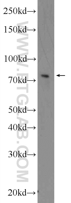 Western Blot (WB) analysis of U-937 cells using ADAM17 Polyclonal antibody (24620-1-AP)