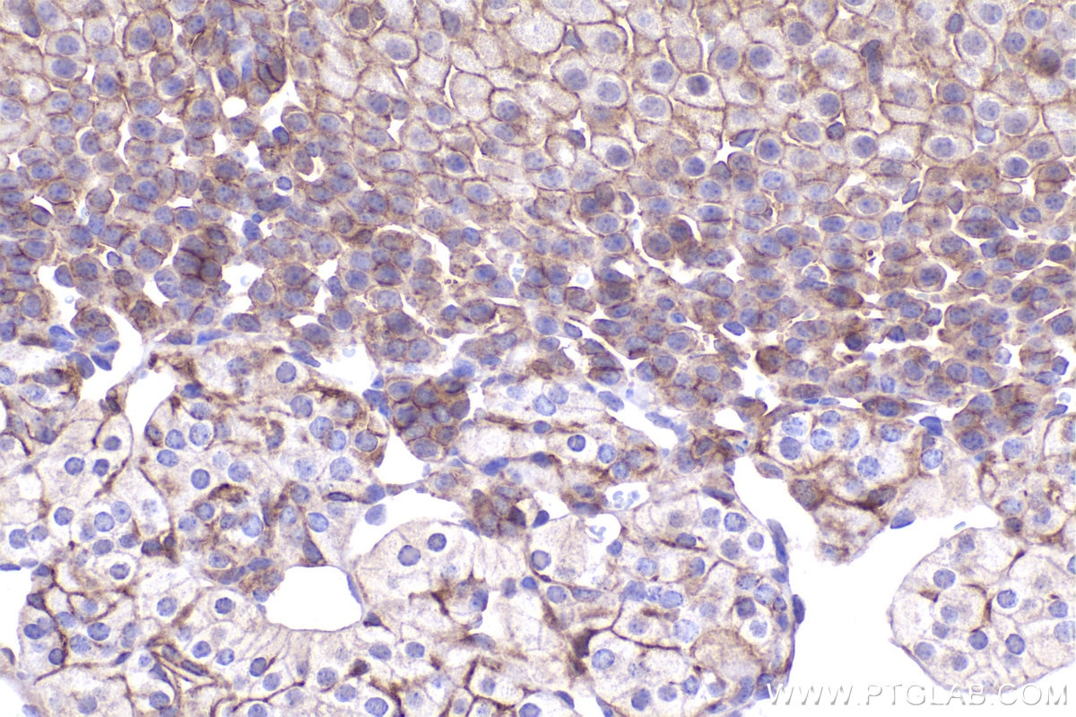IHC staining of mouse adrenal gland using 29948-1-AP Immunohistochemistry (IHC) staining of mouse adrenal gland tissue using ADAM17 Polyclonal antibody (29948-1-AP)