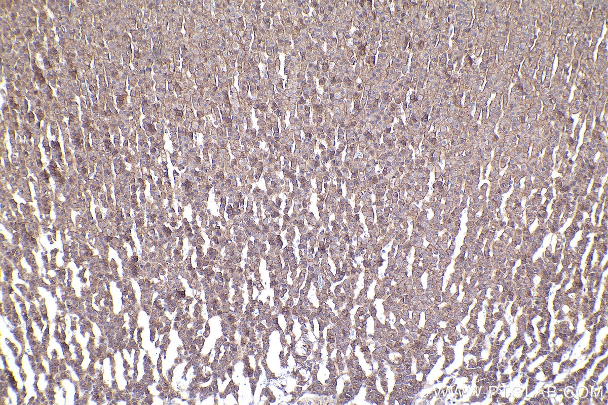 IHC staining of rat adrenal gland using 29948-1-AP Immunohistochemistry (IHC) staining of rat adrenal gland tissue using ADAM17 Polyclonal antibody (29948-1-AP)