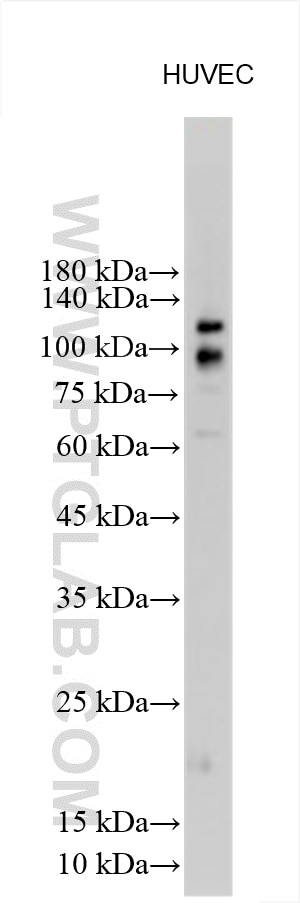 Western Blot (WB) analysis of HUVEC cells using ADAM17 Polyclonal antibody (29948-1-AP)