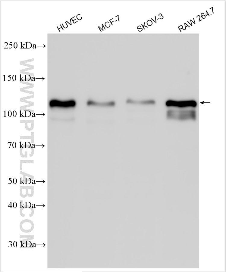 Western Blot (WB) analysis of various lysates using ADAM17 Polyclonal antibody (29948-1-AP)