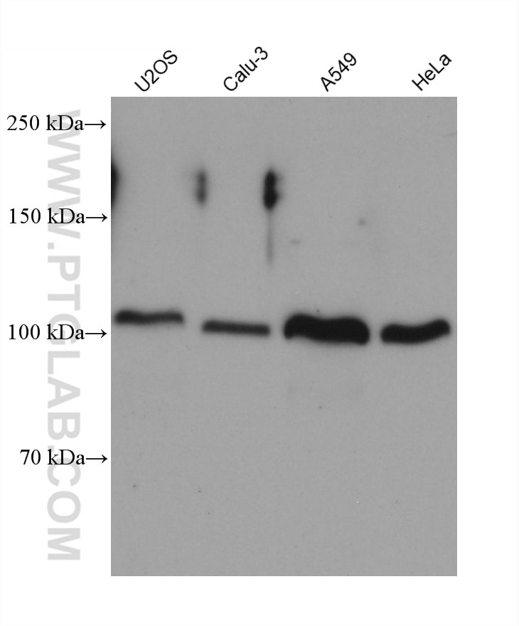 WB analysis using 68725-1-Ig