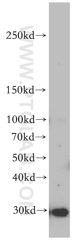 WB analysis of human placenta using 20259-1-AP