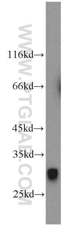 Western Blot (WB) analysis of human placenta tissue using ADAM17-Specific Polyclonal antibody (20259-1-AP)