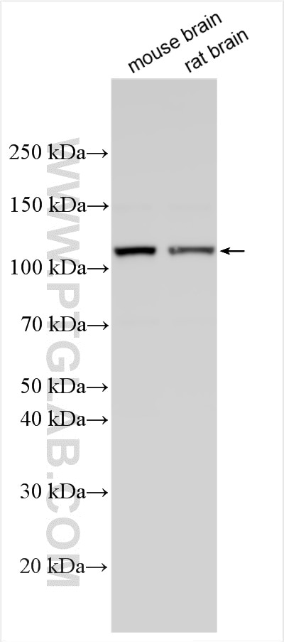 Western Blot (WB) analysis of various lysates using ADAM19 Polyclonal antibody (22216-1-AP)