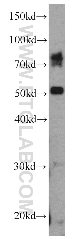 Western Blot (WB) analysis of mouse testis tissue using ADAM2 Polyclonal antibody (13952-1-AP)
